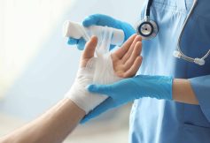 Tips for dealing with a burn injury
